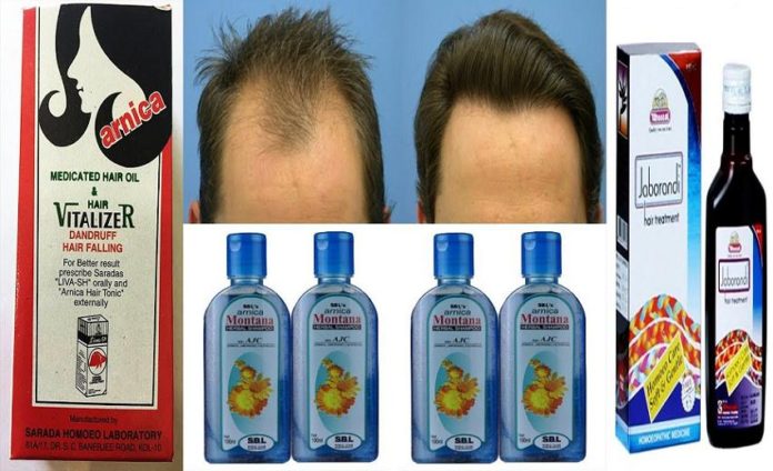 Best Homeopathic Hair Oil For Hair Fall And Hair Regrowth - Homeopathic  Medicine And Treatment